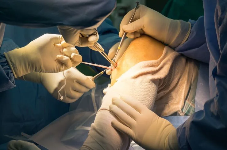 phadkehospital Arthroscopic Surgery